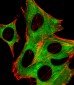 PPP2R5B Antibody (C-term)